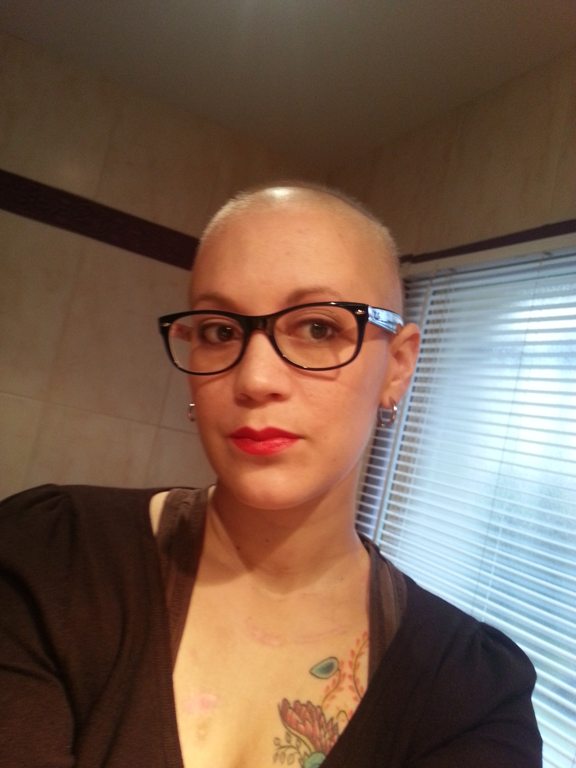 Pas besoin de cheveux pour être une Femme ! :-D (hodgkin stade 3 avancé, 8 mois de chimio, 1 rechute, 4 mois de chimio, 1 autogreffe et 1 allogreffe !) EN REMISSION !!!