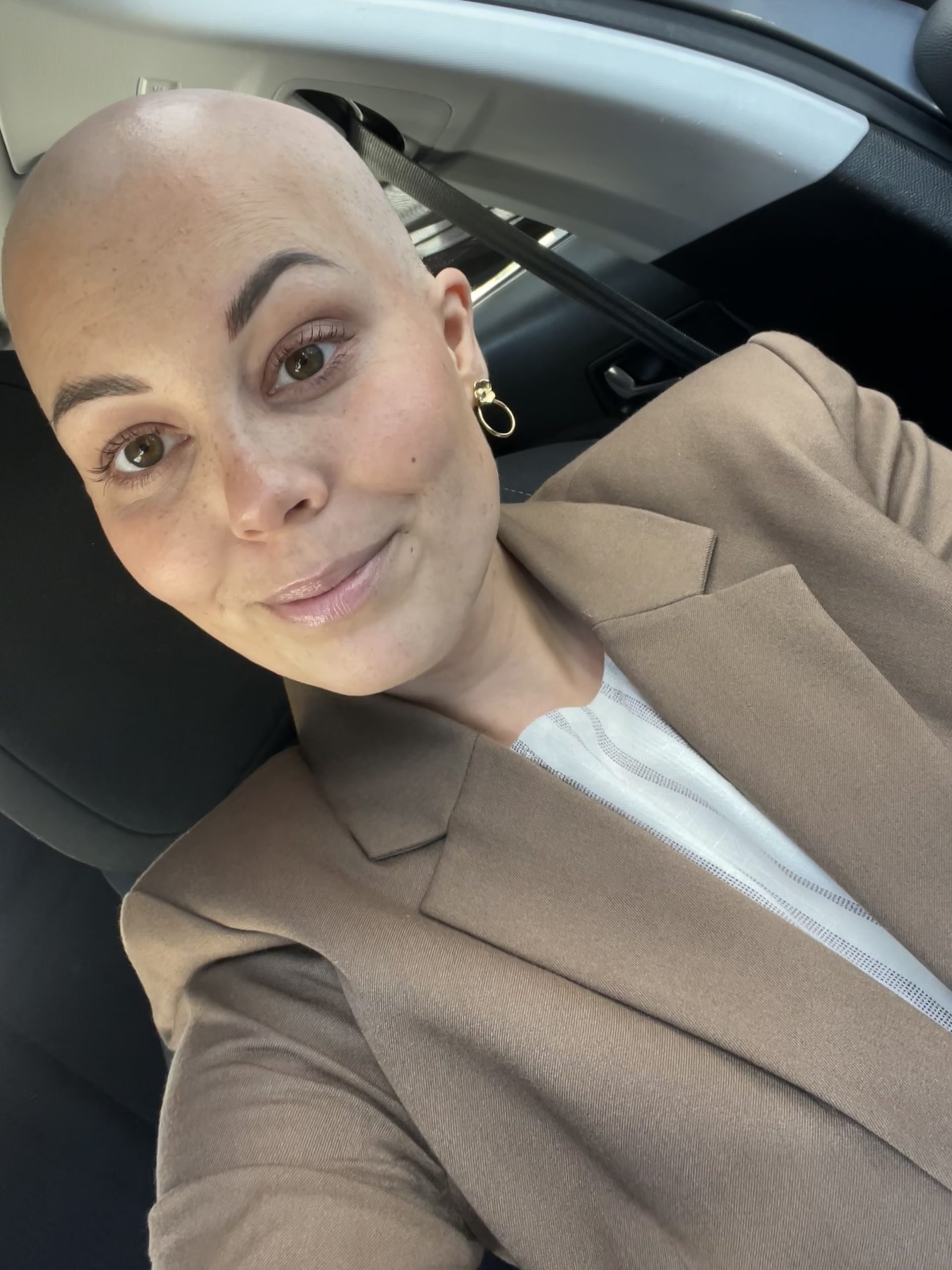 À 30 ans, le cancer du sein m'a appris à habiter ma vie autrement