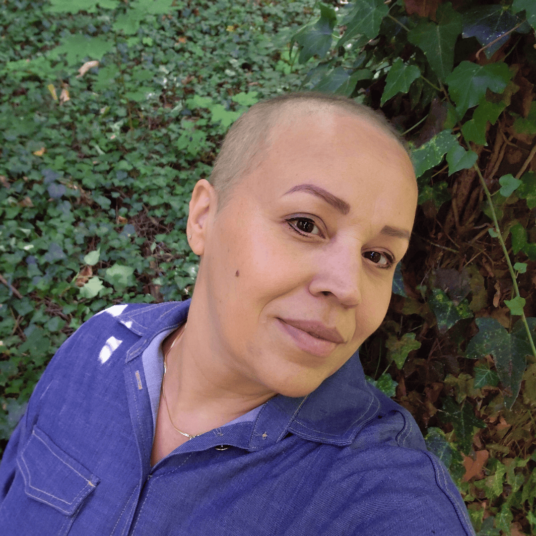 Cancer du sein hormono dépendant stade 3