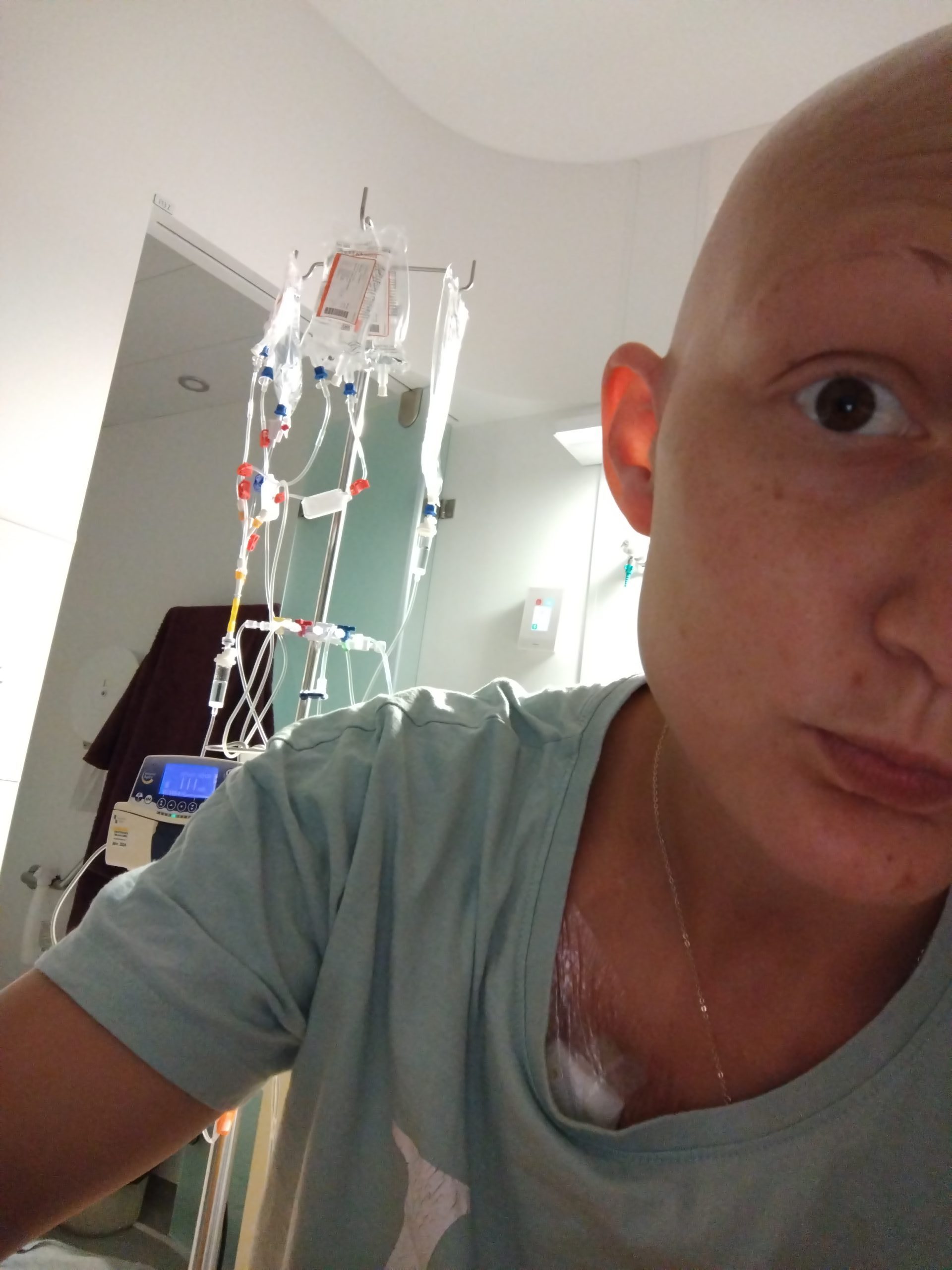 Cancer du col de l&rsquo;utérus, j&rsquo;ai beaucoup de séquelles